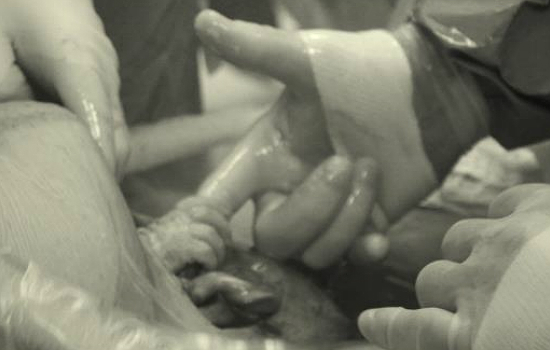 Születése közben fogta meg az orvos ujját  a baba - fotó