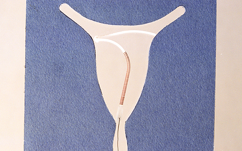 A fogamzásgátló csökkenti a libidót? Milyen más alternatíva létezik?